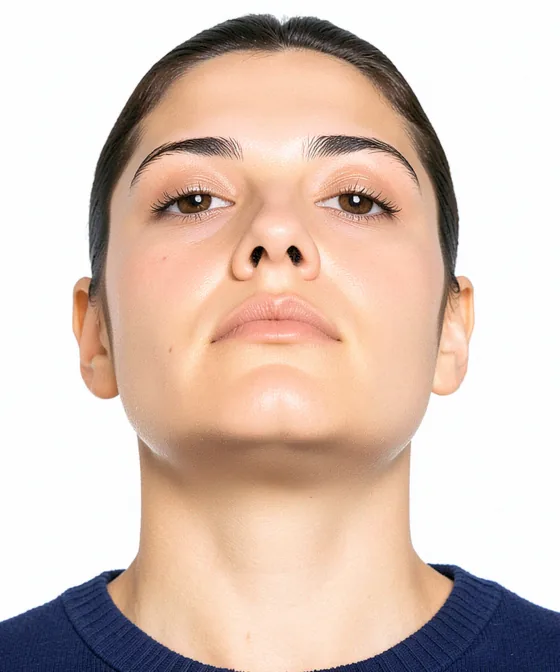 35×45mm Vesikalık — Yanlış vesikalık örneği: alttan yukarı çekim