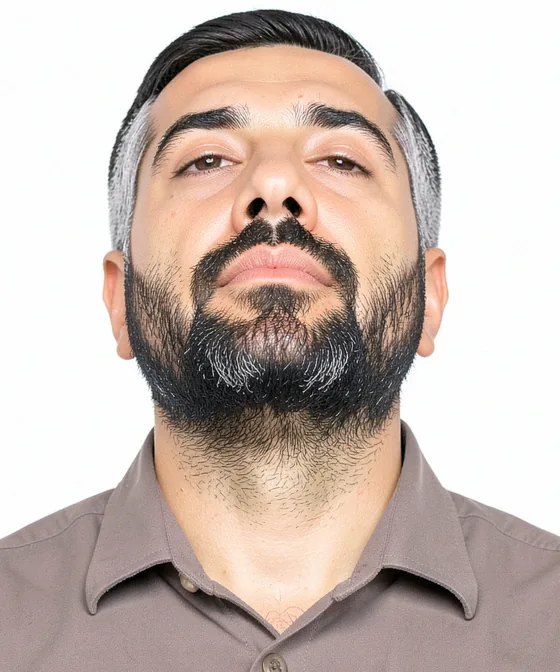 Suriye Pasaportu Fotoğrafı — Yanlış vesikalık örneği: alttan yukarı çekim